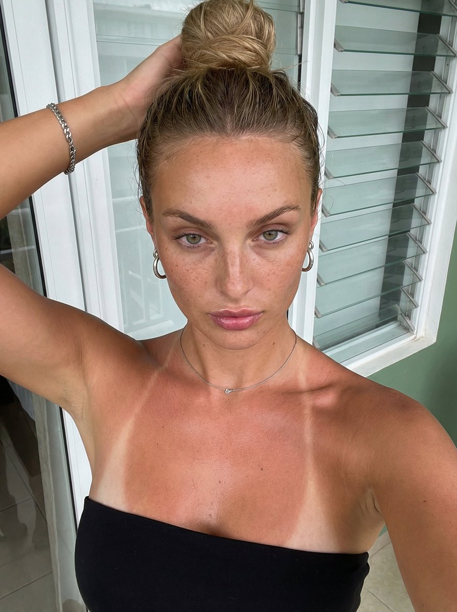 夏日阳台惹火自拍：肌肤上的清晰晒痕